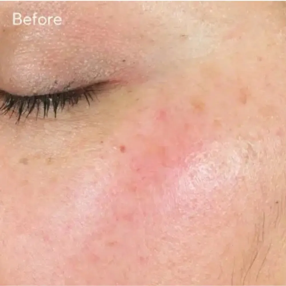 Murad Intense Recovery Cream 7.5ml
